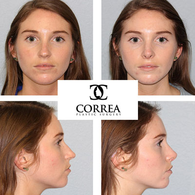 Image for Correa Plastic Surgery with ID of: 1588428