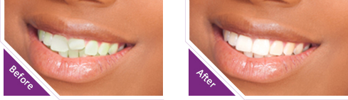 Image for Dentist Ottawa ON with ID of: 1589076