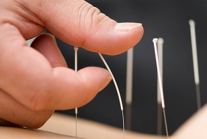 Image for Services on Location Acupuncture yonge & Davisville with ID of: 1593796