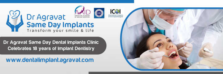 Image for Dr Agravat Same Day Dental Implants Clinic Ahmedabad, Gujarat, India with ID of: 1606162