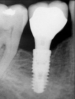 Image for West Cobb Dentistry with ID of: 1612083
