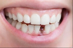 Image for West Cobb Dentistry with ID of: 1612101