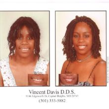 Image for Vincent H. Davis DDS with ID of: 1622928
