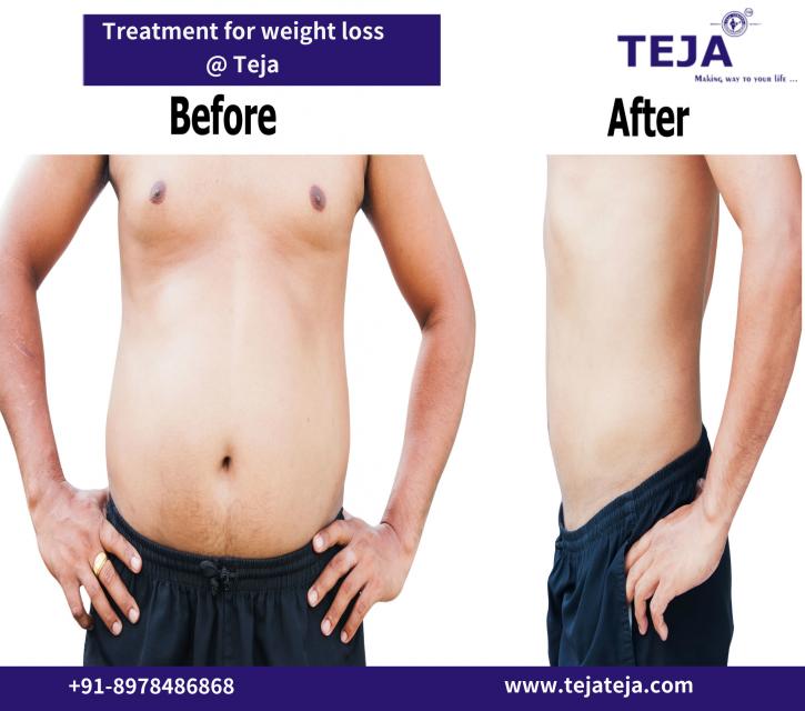 Image for Get a Perfect Body Shape in Single Sitting at Teja's with ID of: 1642863