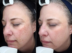 Image for Complexions SkinCare/MedSpa with ID of: 1648646