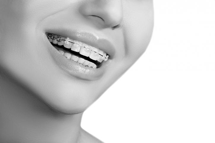 Image for Orthodontics of Downey with ID of: 1651106