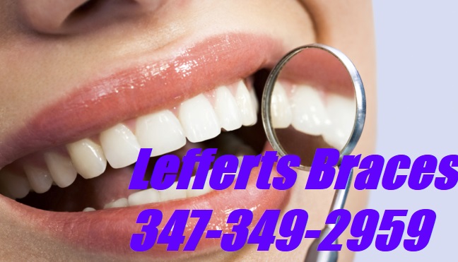 Image for Lefferts Braces with ID of: 1659271