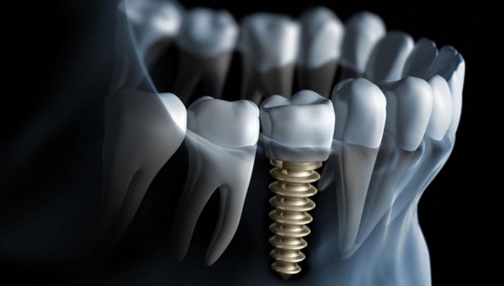 Image for Advanced Dentistry with ID of: 1665153