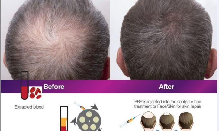 Image for Revive My Hair with ID of: 1676601