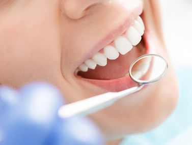 Image for Recommended Root Canal Therapy San Francisco CA - 94127- Dr. Terri Nguyen with ID of: 1689177