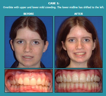 Image for Davis Orthodontics with ID of: 1693746