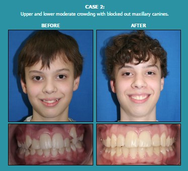 Image for Davis Orthodontics with ID of: 1693747
