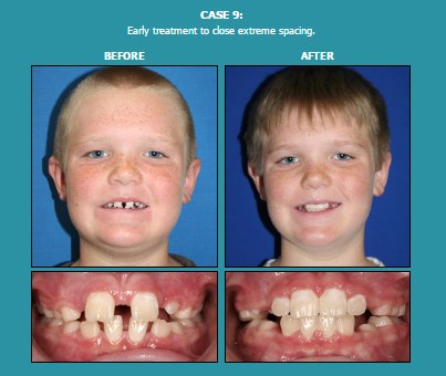 Image for Davis Orthodontics with ID of: 1693749