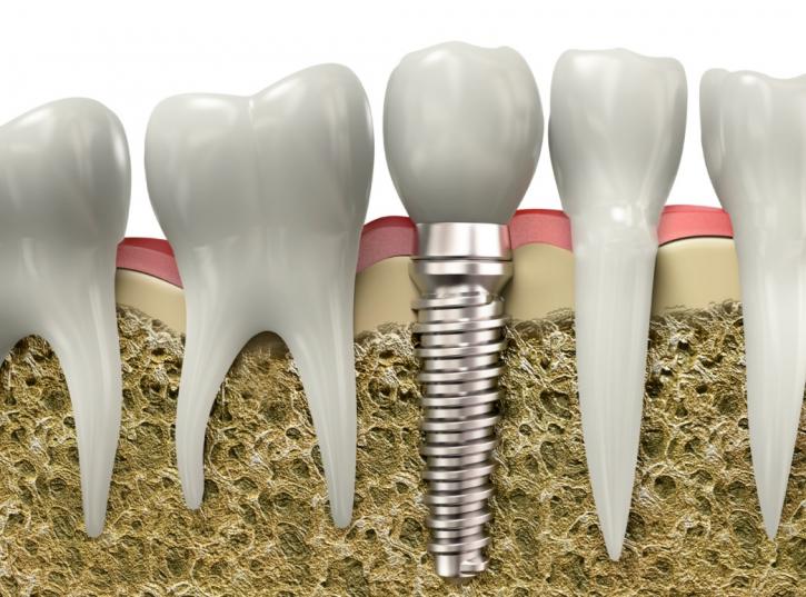 Image for Oro Valley Dental Arts with ID of: 1705905