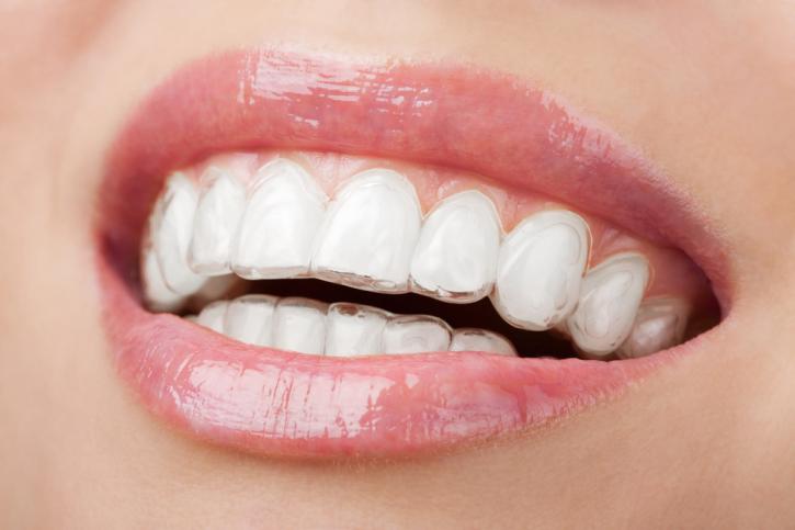 Image for Oro Valley Dental Arts with ID of: 1705911