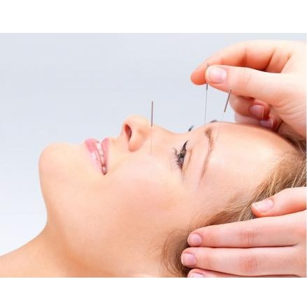 Image for Classical Five Element Acupuncture with ID of: 1707851
