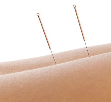 Image for Classical Five Element Acupuncture with ID of: 1707857