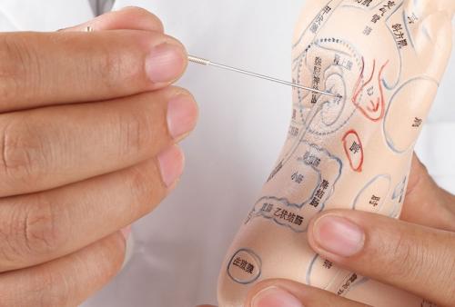 Image for Classical Five Element Acupuncture with ID of: 1707860