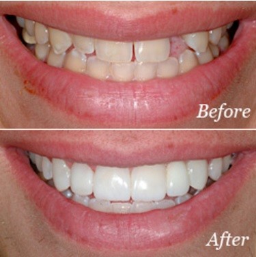 Image for Creekside Dental Arts with ID of: 1718690