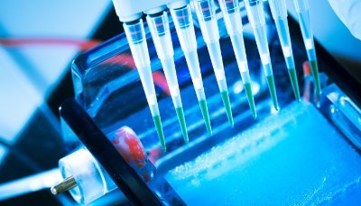 Image for Global In Vitro Diagnostics (IVD) Market Analysis & Forecast, 2016–2024 with ID of: 1736030