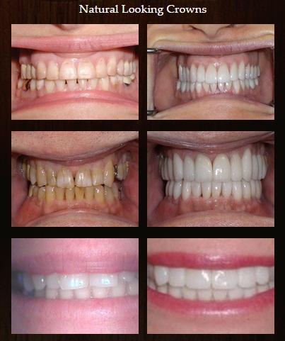 Image for Smiles By Turley with ID of: 1752011