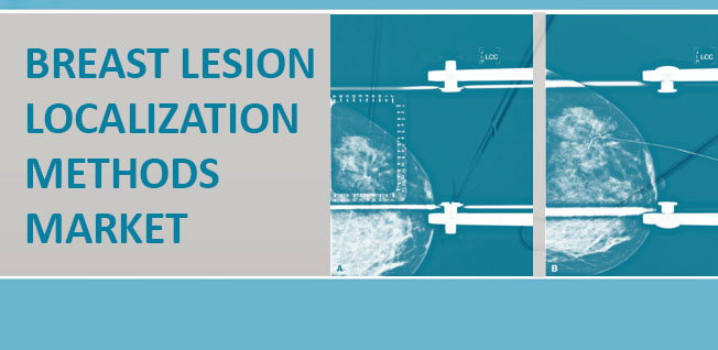 Image for Global Breast Lesion Localization Methods Market, By Technique End User and Geography - Insights, Opportunity Analysis, and Industry Forecast till 2024 with ID of: 1758924