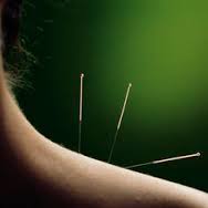 Image for Acupuncture in Ellicott City with ID of: 1763007