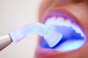 Image for Dental Curing Lights Market Dynamics And Growth Rate 2017-2021 with ID of: 1786215