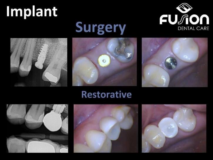 Image for Fusion Dental Care with ID of: 1793217