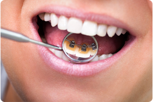 Image for Murray Orthodontics with ID of: 1794287