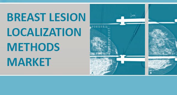 Image for Global breast lesion localization methods market was valued at US$ 400.9 million in 2015 and is expected to witness a robust CAGR of 11.0% during the forecast period (2016 – 2024) with ID of: 1802773