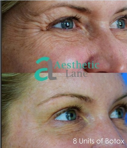 Image for Aesthetic Lane with ID of: 1834775