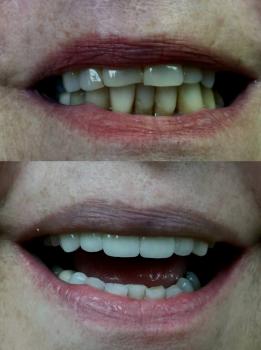Image for Florida Dental Rejuvenation with ID of: 1854231