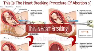Image for Abortion-API Insights, 2017 with ID of: 1860702