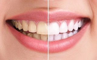 Image for Burnaby Square Dental with ID of: 1868153