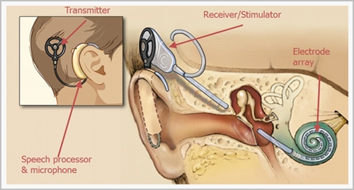 Image for SpHear Speech & Hearing Clinic with ID of: 1873086