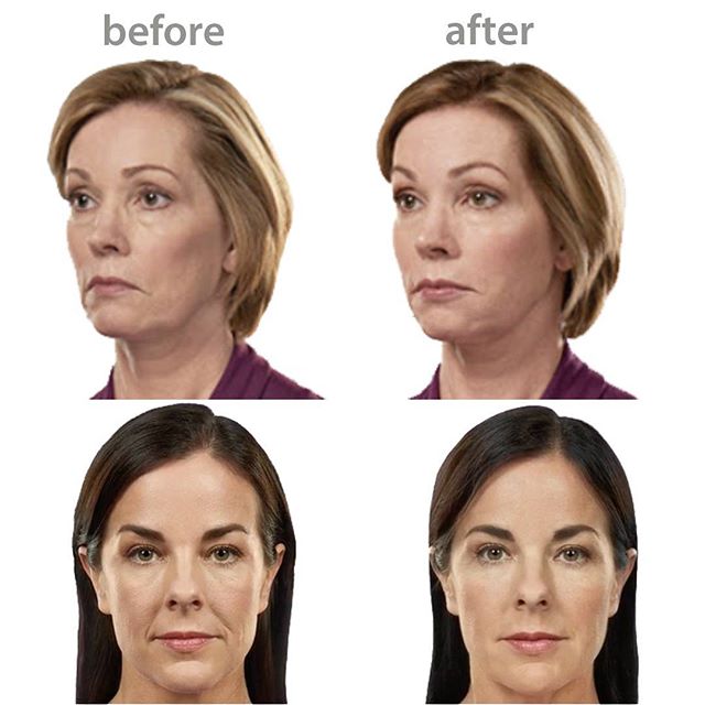 Image for Lift MD Aesthetics with ID of: 1876772