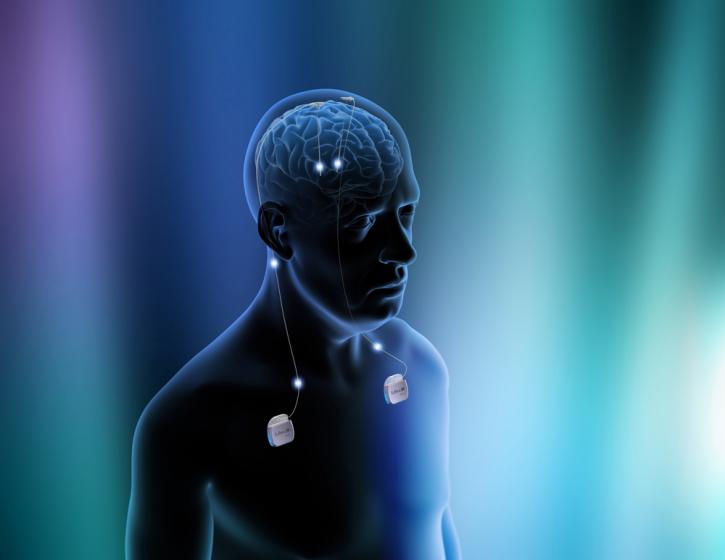 Image for Global Deep Brain Stimulation Devices Market - Global Industry Insights, 2016–2024 with ID of: 1927913