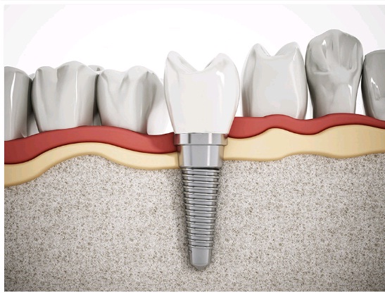 Image for Dental Smiles with ID of: 1930740