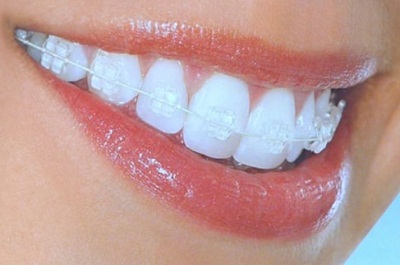 Image for Budget Dentistry with ID of: 1942284