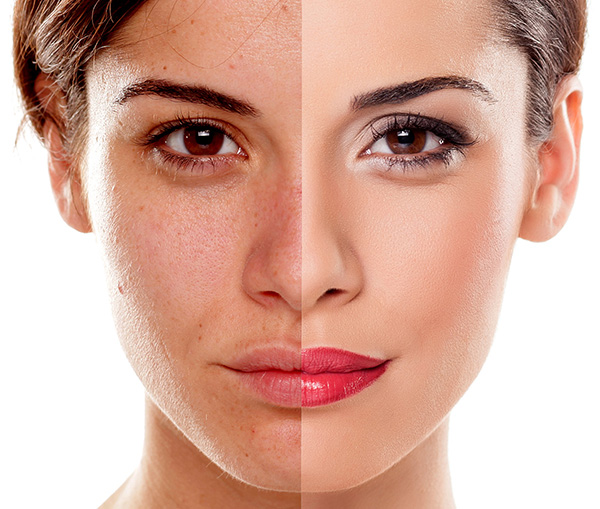 Image for Flawless Fillers with ID of: 1946606