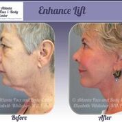 Image for Atlanta Face & Body with ID of: 1954119