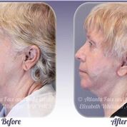Image for Atlanta Face & Body with ID of: 1954149