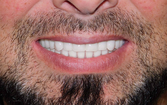 Image for Premier Dentures with ID of: 1958660