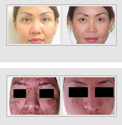 Image for Laser Skin Care Center with ID of: 1964266