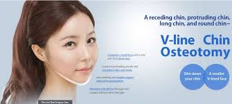 Image for Results to Expect through Korean Breast Implants with ID of: 1990443