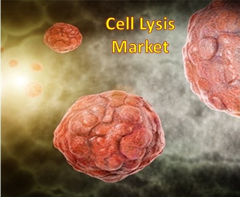 Image for Cell Lysis Market - Industry Analysis, Size, Share, Growth, Trends and Forecast to 2025 with ID of: 2008944