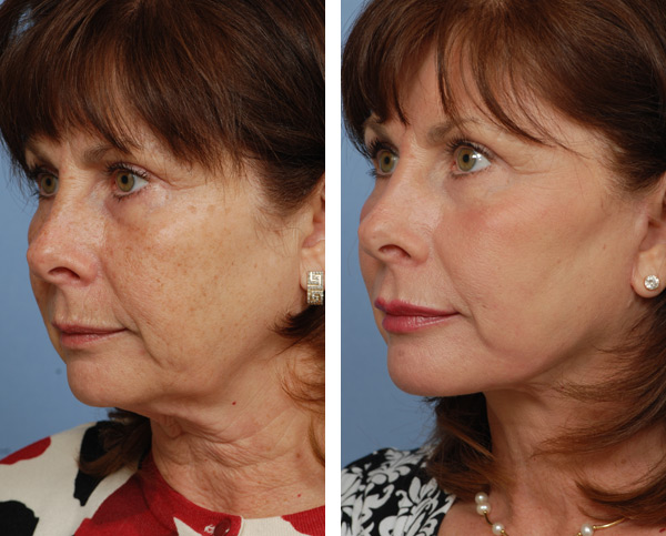 Image for NeckCream.org with ID of: 2011386