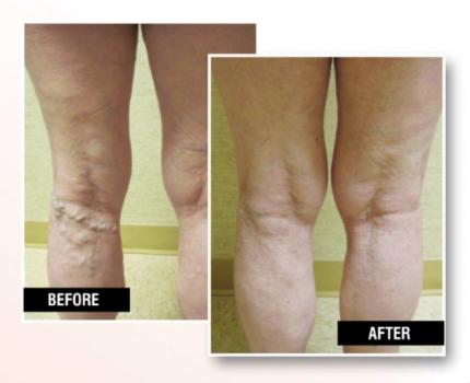 Image for USA Vein Clinics with ID of: 2035957