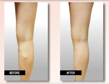 Image for USA Vein Clinics with ID of: 2036325